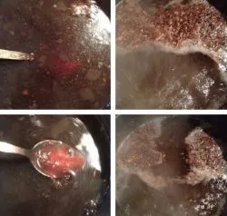 Pot să fac baie copilul cu varicela cand si cum (la baie) Este posibil să când și cum să se scalde copilul cu varicela