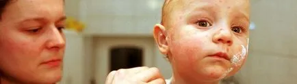 Pot să fac baie copilului cu varicela atunci când se poate scălda copilul dupa varicela (scălda) Pot să fac baie copilului cu varicela atunci când se poate scălda copilul dupa varicela