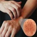 O întâlnire cu un dermatolog