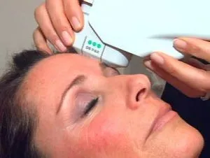 Radiolifting fata - acum si cuptoare cu microunde de lucru în cosmetologie (durează aproximativ o jumătate de oră) Radiolifting fata - acum si cuptoare cu microunde lucrează în cosmetologie