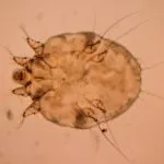 râia sarcoptică la oameni că este, simptome si tratament este infectia se produce