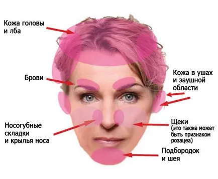 dermatita seboreica pe fata de cauze, simptome, tratament