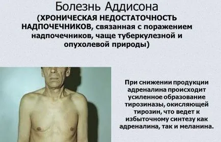 hormoni steroizi - ceea ce este