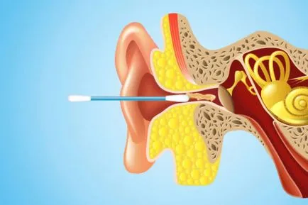proprietăți importante și utile cerumen ale compoziției (compoziția earwax) proprietăți cerumen importante și utile ale compoziției