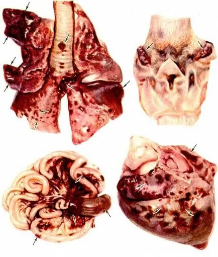 Vasculita - diagnostic, simptome, clasificarea și tratamentul bolii