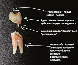 Ce este un bolț de ancorare