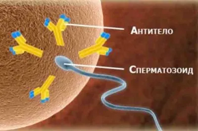 Analiza antisperm-l