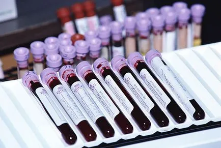 Diagnosticul de sifilis