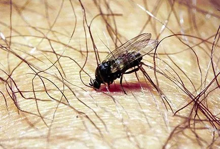 Alergică la mușcătura de musculițe Alergică la mușcătura de musculițe