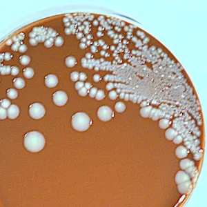 Proteus mirabilis, ceea ce este Proteus mirabilis, ceea ce este