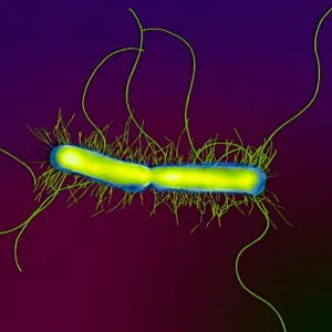 Proteus mirabilis, ceea ce este Proteus mirabilis, ceea ce este