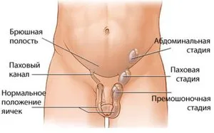 picior in gat, in zona abdomenului, care este picior in gat, in zona abdomenului, care este