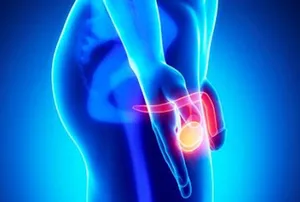 picior in gat, in zona abdomenului, care este picior in gat, in zona abdomenului, care este