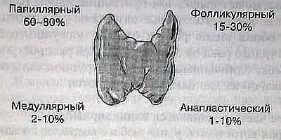 Ansamblu de eliminare tiroidă Ansamblu de eliminare tiroidă