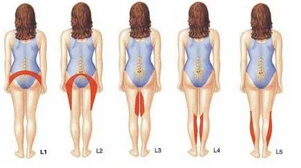Efecte Hernia-l