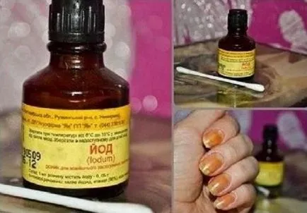 Ce se poate vindeca ciuperca unghiilor Ce se poate vindeca ciuperca unghiilor