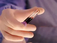test de sânge HVC ce este