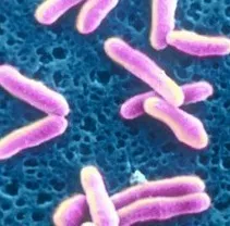 Difteria este că copilul Difteria este că copilul