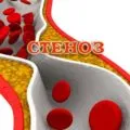 Tratamentul encefalopatiei cerebral