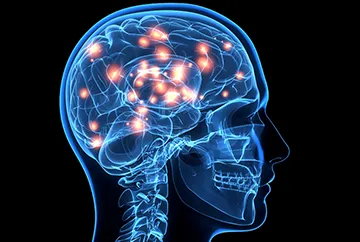 Tratamentul encefalopatiei cerebral