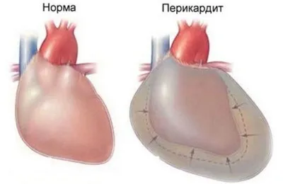 Ce este o ecocardiografie Ce este o ecocardiografie
