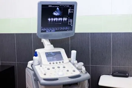 Ce este o ecocardiografie