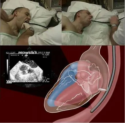 Ce este o ecocardiografie