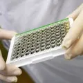 test de sânge HVC ce este test de sânge HVC ce este