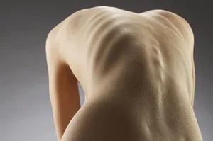 hormoni ovarieni