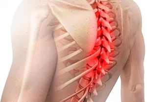 Efecte Hernia-l