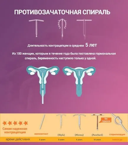 Intrauterine spirală Hormonale