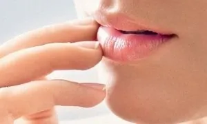 Impetigo este ceea ce este Impetigo este ceea ce este