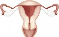 Cum de a restabili uterului Cum de a restabili uterului