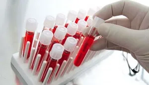 Cum de a închiria un test de sânge comun Cum de a închiria un test de sânge comun