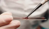 Cum de a închiria un test de sânge comun
