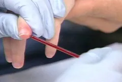 Cum de a închiria un test de sânge comun Cum de a închiria un test de sânge comun