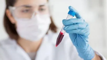 Cum de a închiria un test de sânge comun Cum de a închiria un test de sânge comun