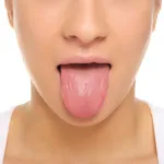 Cum de a defini ca o contuzie