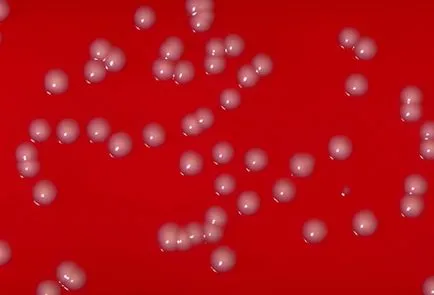 Ce este Corynebacterium