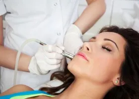 Cum se curata un laser