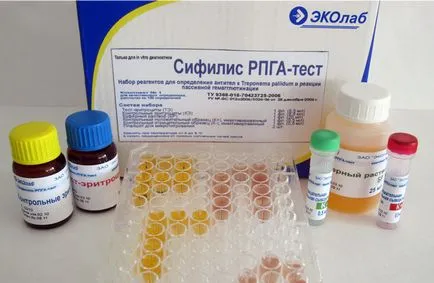 Diagnosticul de sifilis