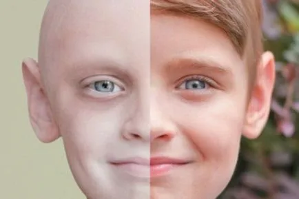 Limfocitele la copii, care este