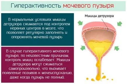 Preparate pentru tratarea urolitiaza