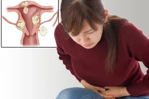Ce se va întâmpla dacă există fibroame