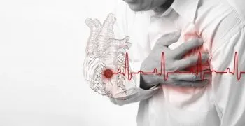 prognoze miocardice prognoze miocardice