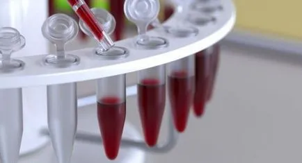 Cum de a închiria un test de sânge comun Cum de a închiria un test de sânge comun
