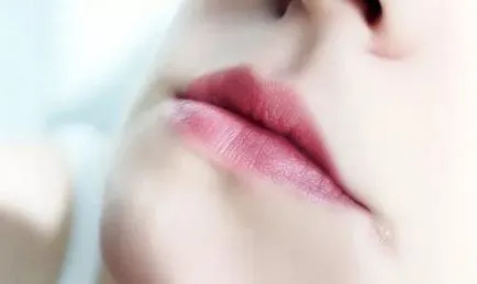 Din ceea ce fisura zona de buze Din ceea ce fisura zona de buze