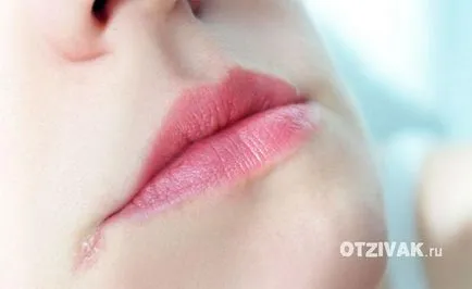 Din ceea ce fisura zona de buze