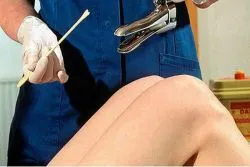 Însămânțarea canalului cervical care este