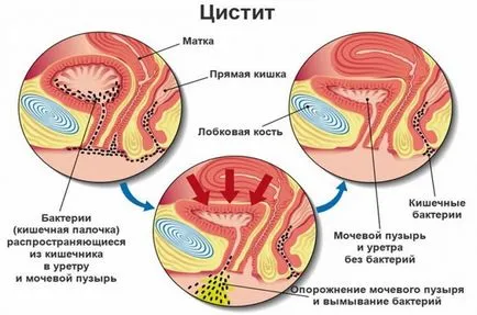 stomac Tras ca inainte de menstruatie stomac Tras ca inainte de menstruatie